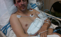 phil-laak-after-atv-accident.jpg